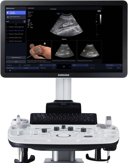 Ecógrafo Samsung HS30 para ecografía musculoesquelética en Fixus Madrid